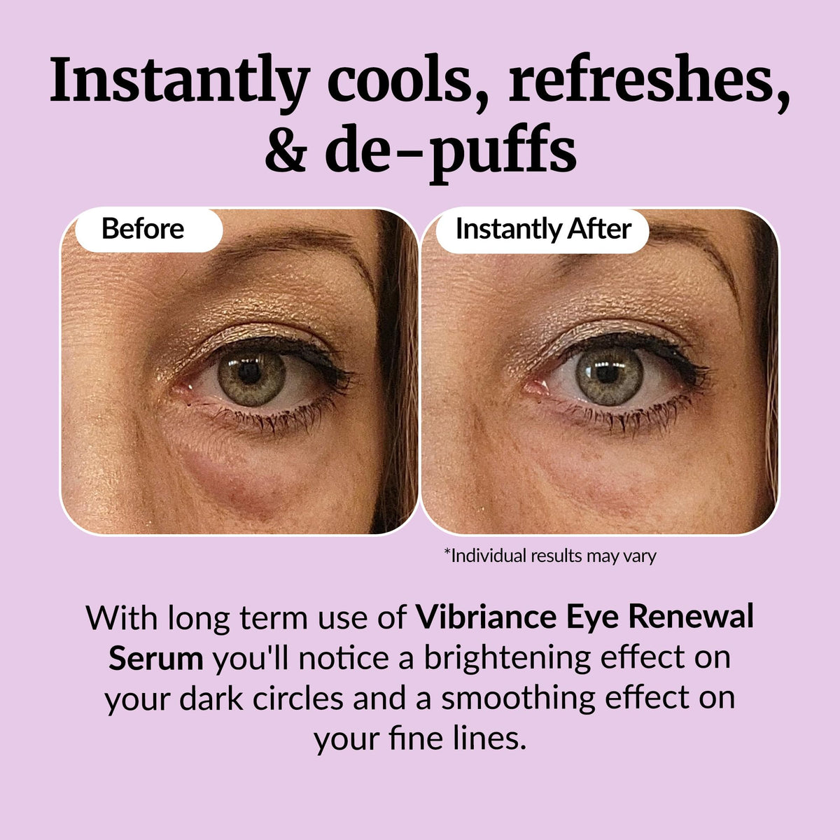 Vibriance Eye Renewal Serum - Caffeine-Infused Treatment for Dark Circles, Puffiness & Under-Eye Bags