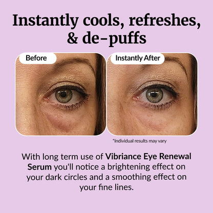 Vibriance Eye Renewal Serum - Caffeine-Infused Treatment for Dark Circles, Puffiness & Under-Eye Bags