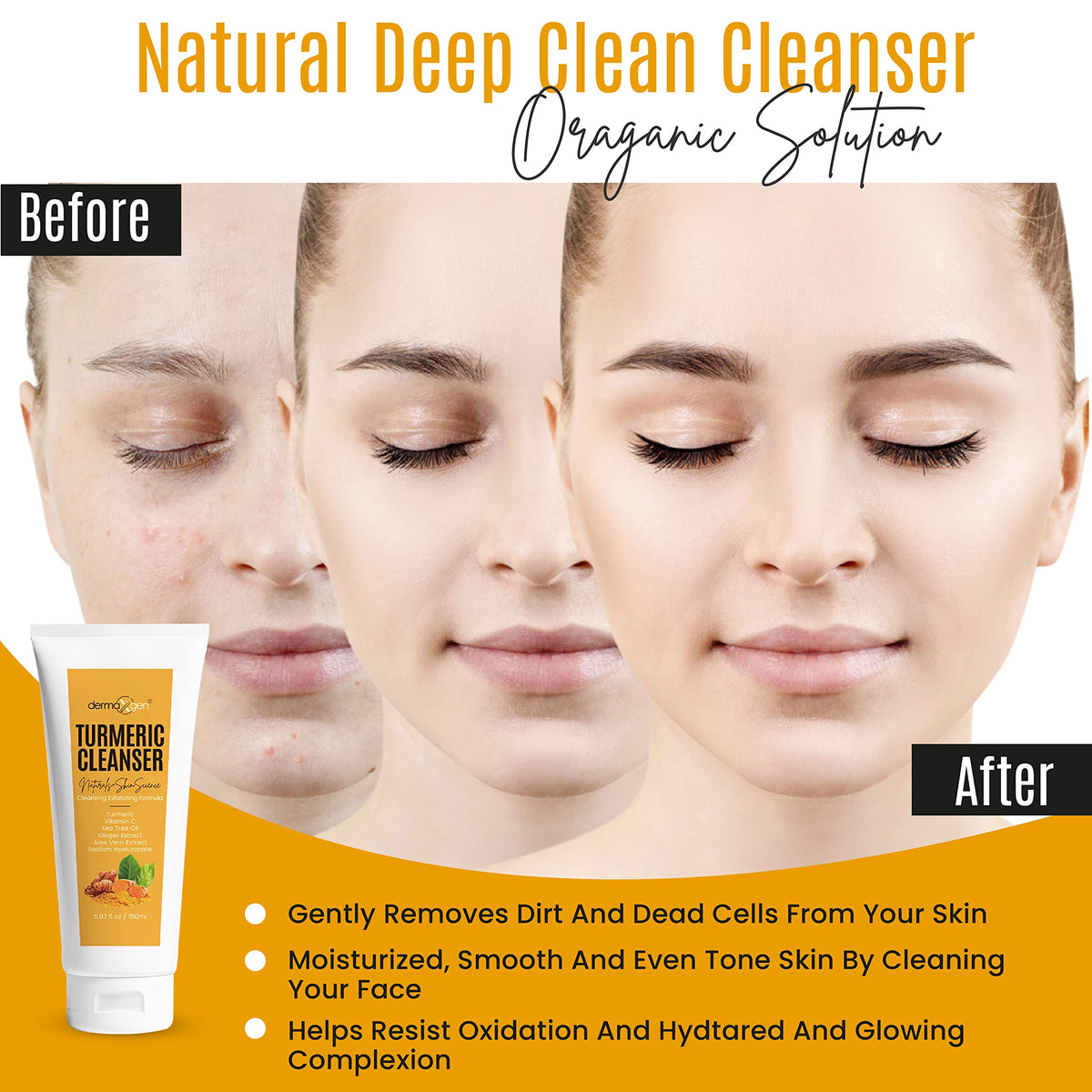 DERMAXGEN Turmeric Facial Cleanser - Natural Anti-Aging Exfoliating Face Wash for Acne Scars & Dark Spots (5 oz)