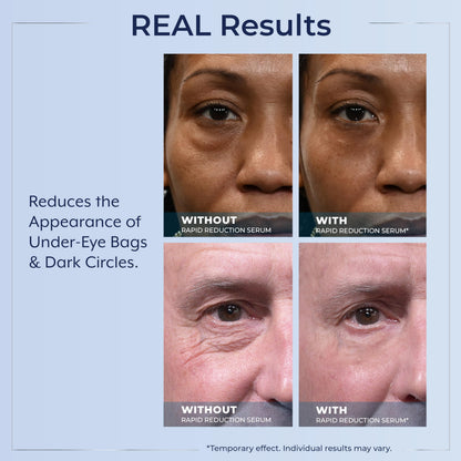 Plexaderm Rapid Reduction Eye Serum - Instant Results for Under-Eye Bags, Wrinkles & Dark Circles (Pump)