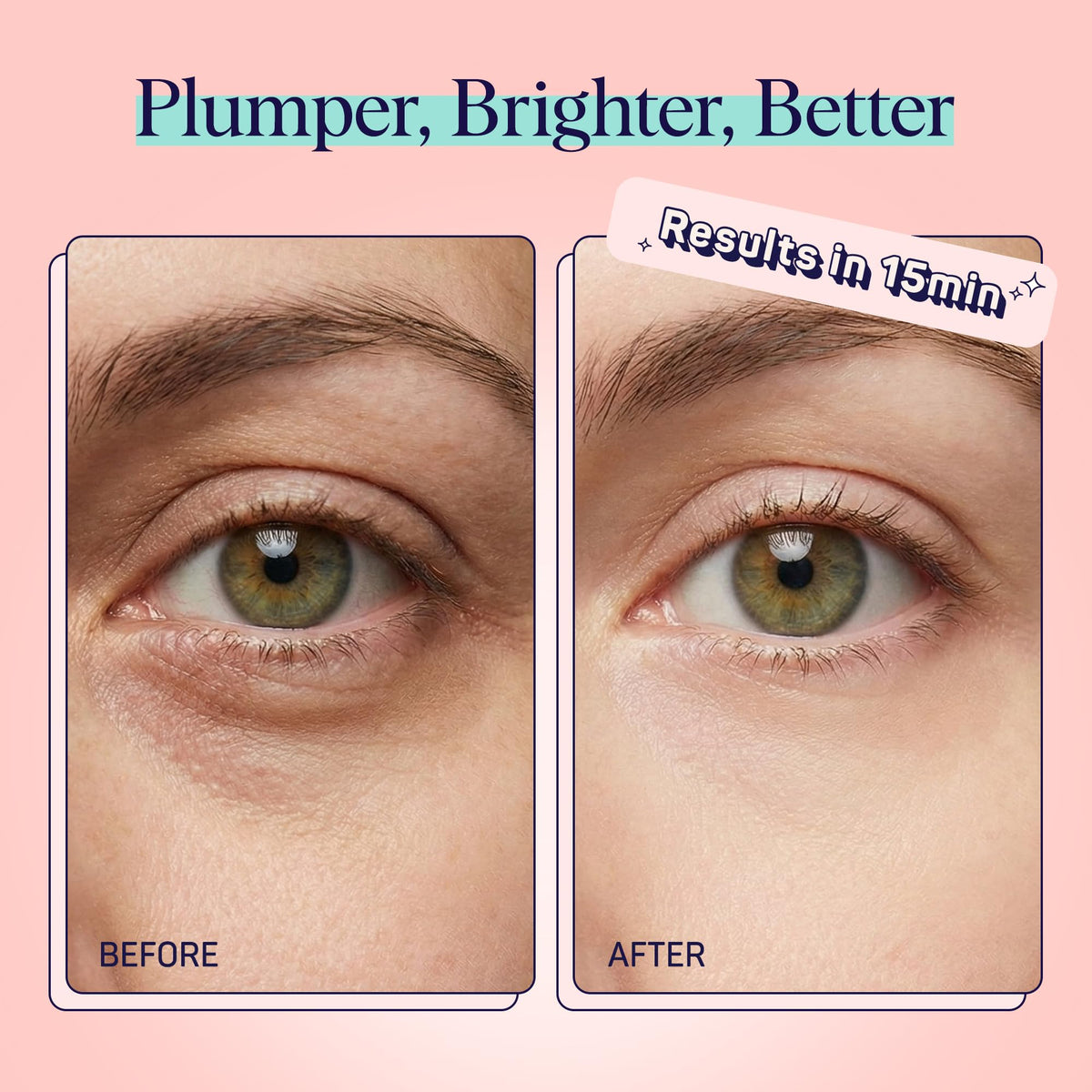 SpaLife Watermelon Cooling Eye Pads – 48 Hydrating Under Eye Patches for Puffiness, Dark Circles & Tired Eyes