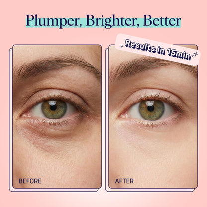 SpaLife Watermelon Cooling Eye Pads – 48 Hydrating Under Eye Patches for Puffiness, Dark Circles & Tired Eyes