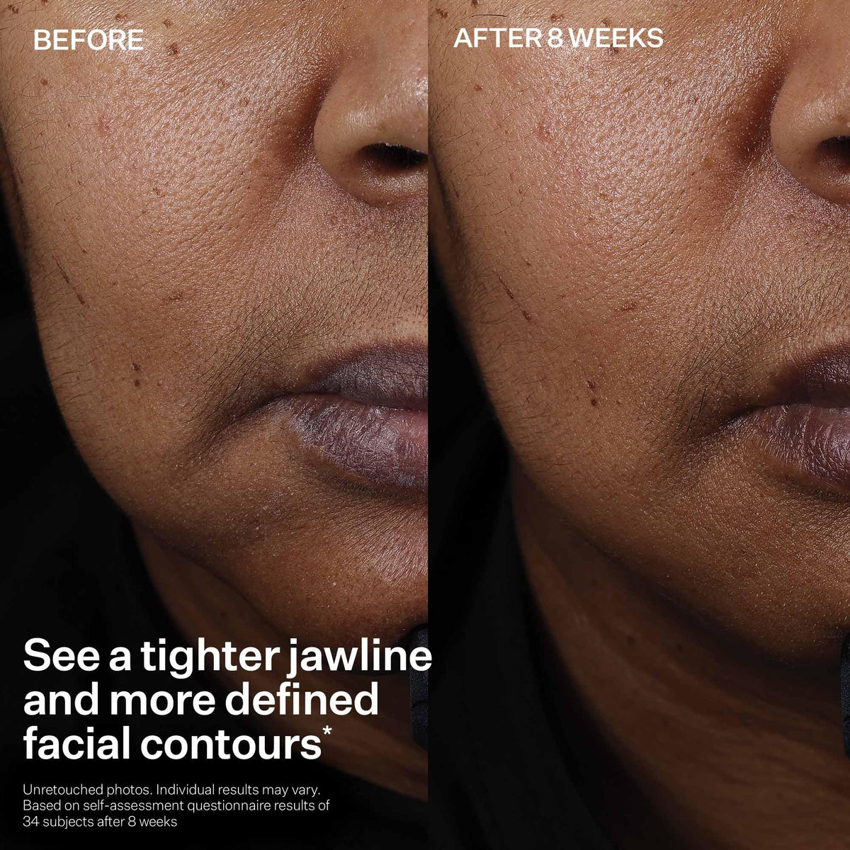 StriVectin Peptight™ Face Lift Serum (30 mL) - Tightening & Brightening Peptides for Wrinkles and Facial Contours
