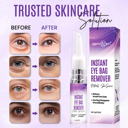 Dermaxgen Instant Under Eye Bag Remover Cream – Dark Circles & Puffiness Treatment, Anti-Aging Eye Cream for Wrinkles and Tired Skin – 0.21 oz