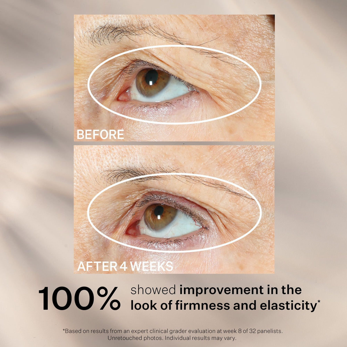 StriVectin Peptight™ 360° Tightening Eye Serum (1 fl. oz) - Advanced Peptides for Wrinkles, Eye Bags & Sagging Lids