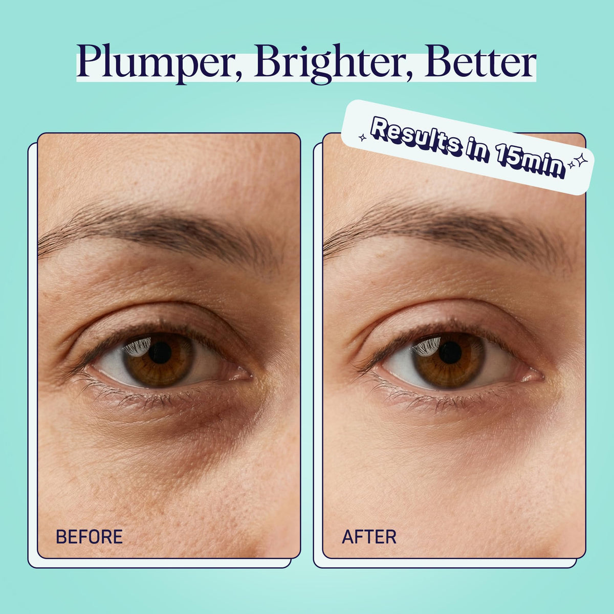 SpaLife Cooling Cucumber Eye Pads – 48 Under Eye Patches for Dark Circles, Puffy Eyes & Daily Depuffing Treatment