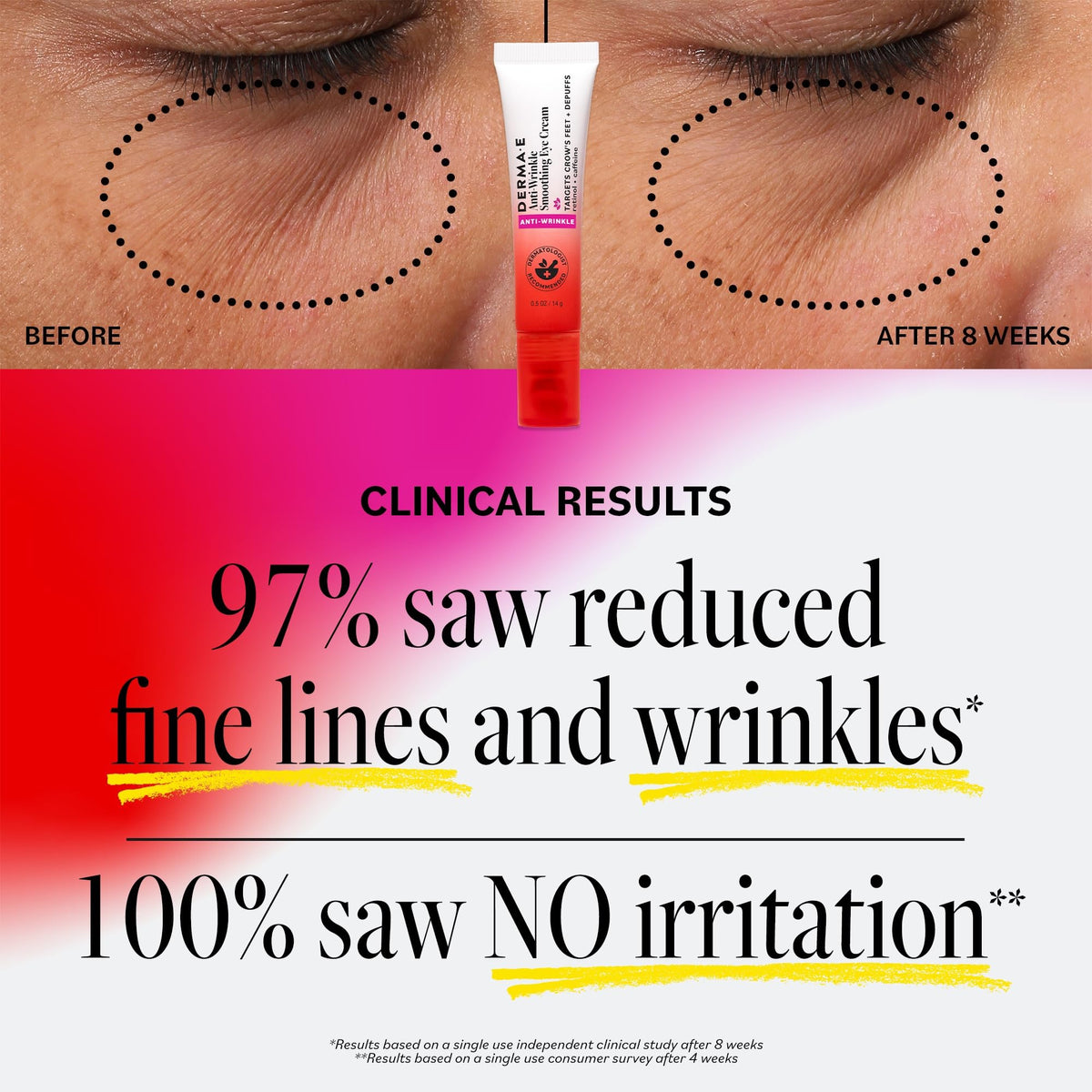 Derma E Anti-Wrinkle Smoothing Eye Cream – Retinol & Caffeine Complex