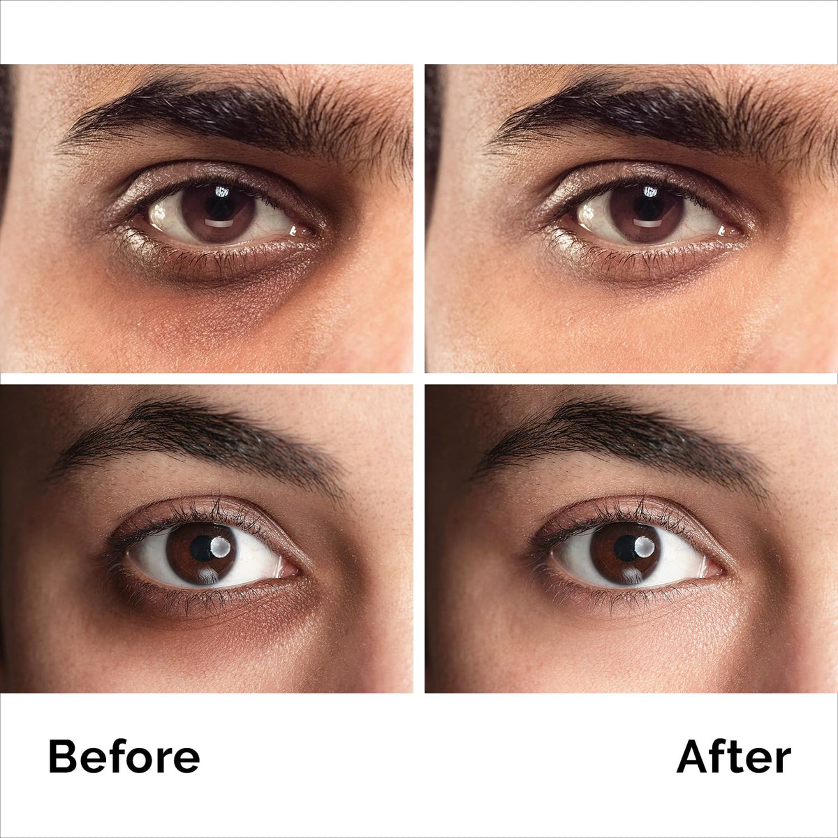 Caffeine Anti-Aging Eye Cream (1.7oz) – Advanced Treatment for Dark Circles, Eye Bags & Puffiness | Instant Face & Eye Lift for Men & Women