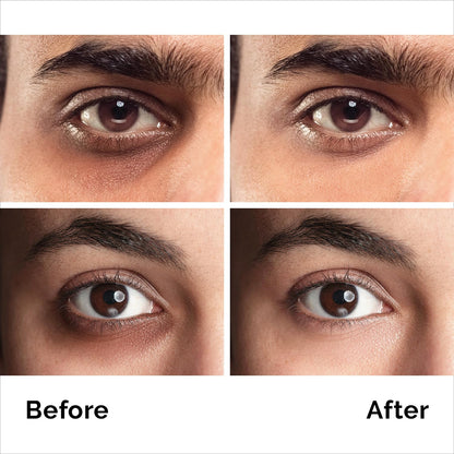 Caffeine Anti-Aging Eye Cream (1.7oz) – Advanced Treatment for Dark Circles, Eye Bags & Puffiness | Instant Face & Eye Lift for Men & Women