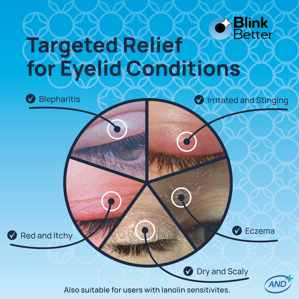 BlinkBetter Lanolin-Free Eyelid Ointment (10g) – Soothing & Hydrating Care for Dry, Itchy, Red & Flaky Eyelids