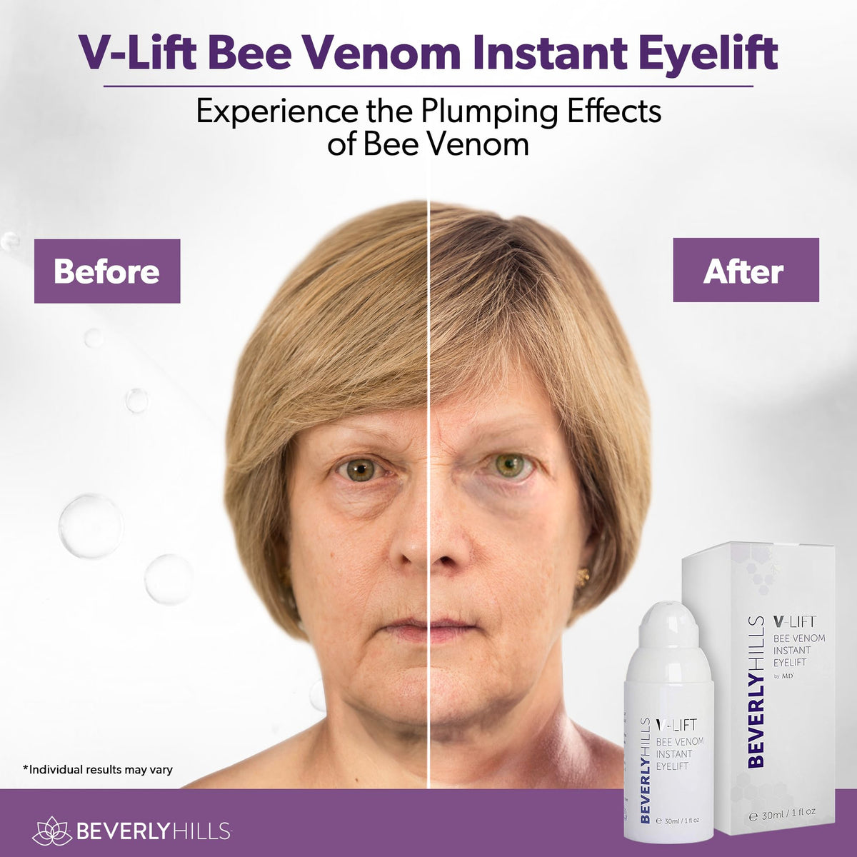 Beverly Hills V-Lift Instant Eye Lift Bee Venom Serum – Firming Eye Treatment for Puffiness, Dark Circles & Wrinkles (30mL)