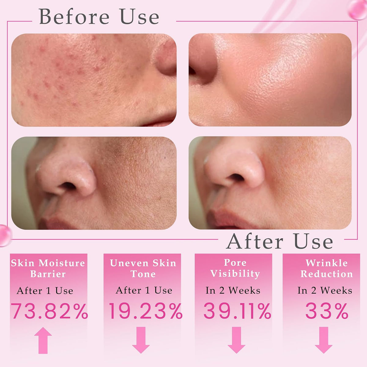 PDRN Pink Peptide Serum - 100% Natural, Vegan PDRN Serum (1 fl oz, 30ml) - Multi-Peptide & Hyaluronic, Skin Barrier Support, Wrinkle & Pore Care, Firming, Hydration Glow, Rose PDRN (Sodium DNA)