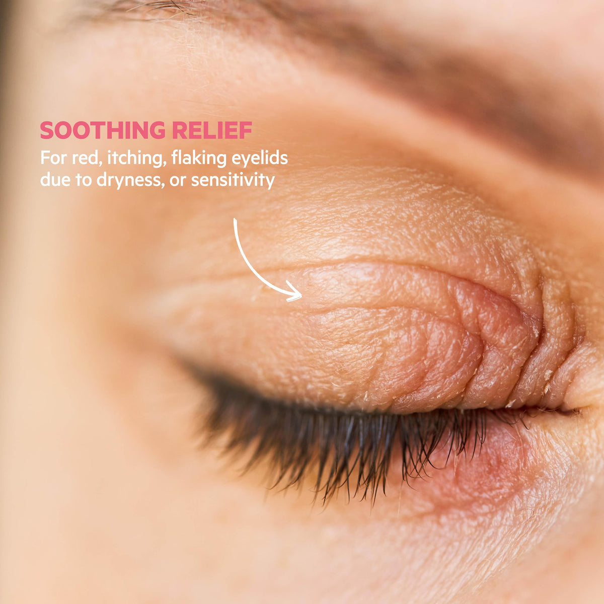 SVR Topialyse Palpebral Eye Cream – Soothing Eye Cream for Dry, Itchy & Sensitive Eyelids 15ml