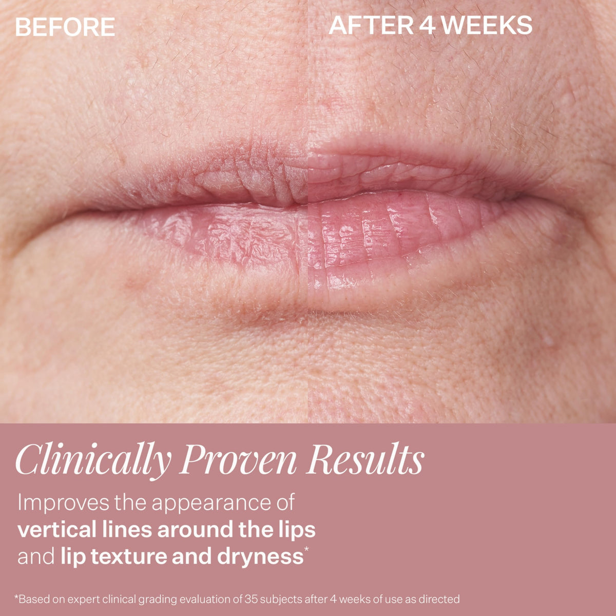 StriVectin DoubleFix for Lips 2-in-1 Lip Plumping Treatment & Vertical Line Smoothing Lip Care