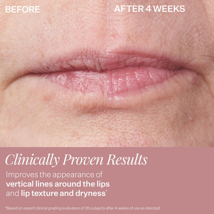 StriVectin DoubleFix for Lips 2-in-1 Lip Plumping Treatment & Vertical Line Smoothing Lip Care
