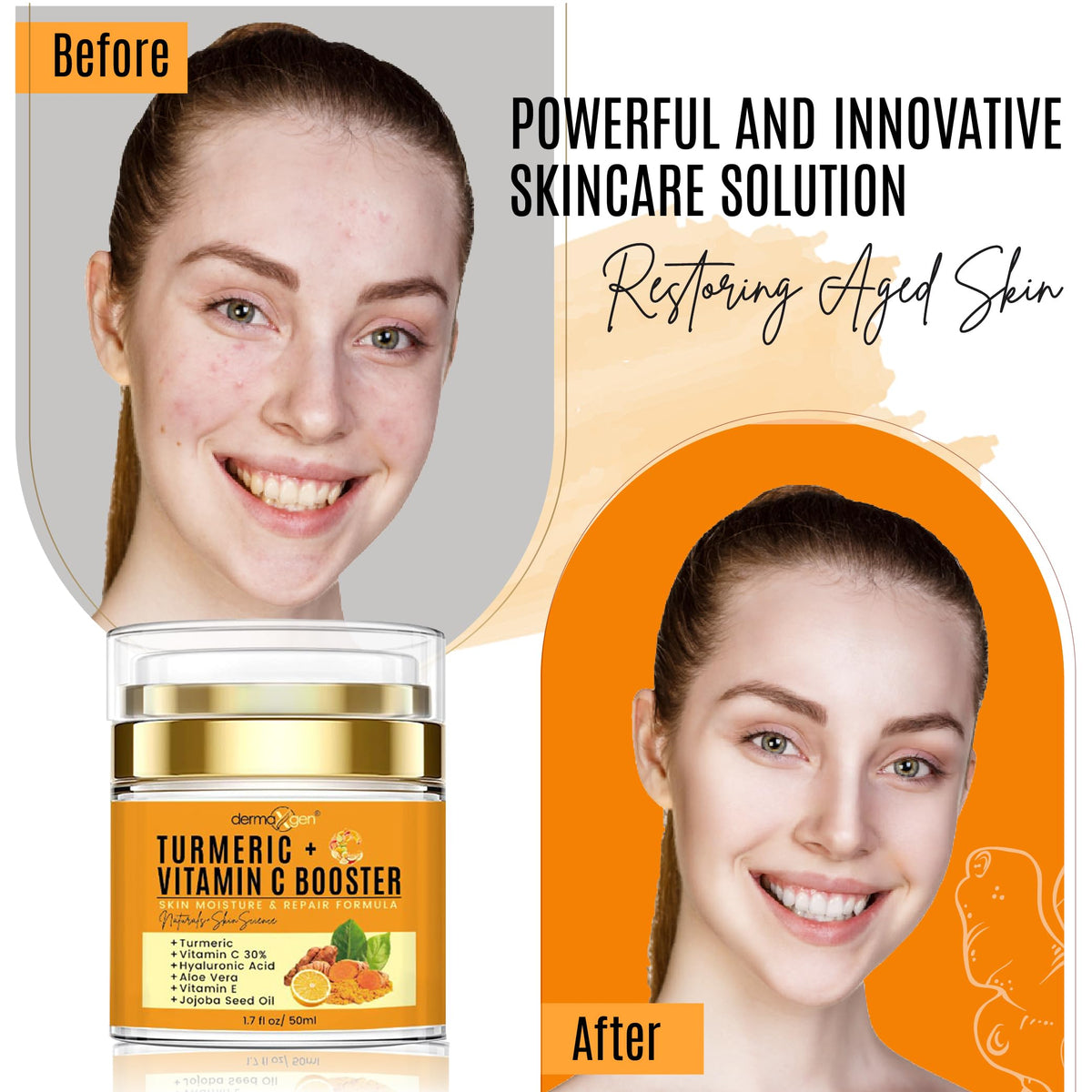 Dermaxgen Turmeric Face Cream with 30% Vitamin C - Glow Booster & Anti-Aging Moisturizer for Dark Spots & Skin Repair (1.7 fl. oz)