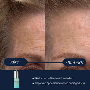 ELEMIS Pro-Collagen Renewal Serum 15ml, Gentle Retinol Alternative for Smoothing Fine Lines & Wrinkles