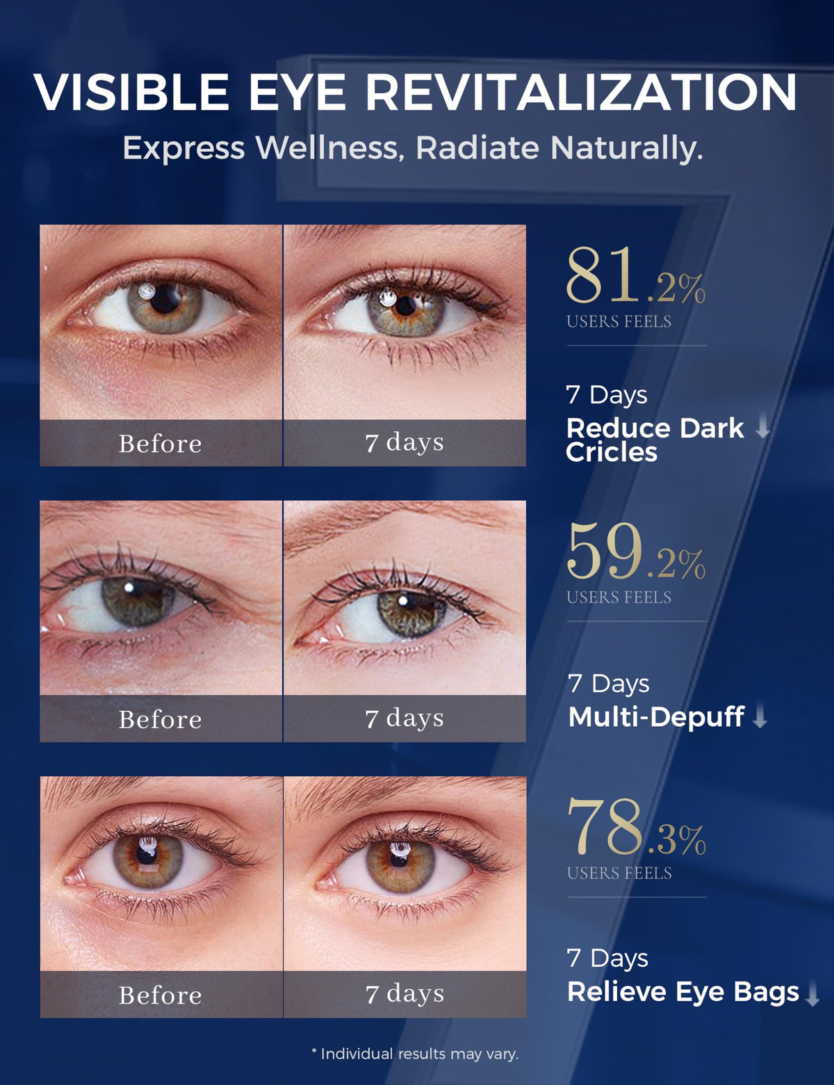 EXPRESSIONS WELLNESS Retinol Eye Cream - Korean Under Eye Cream with Tranexamic Acid, Caffeine & Peptides for Dark Circles & Puffiness (1.06 oz.)