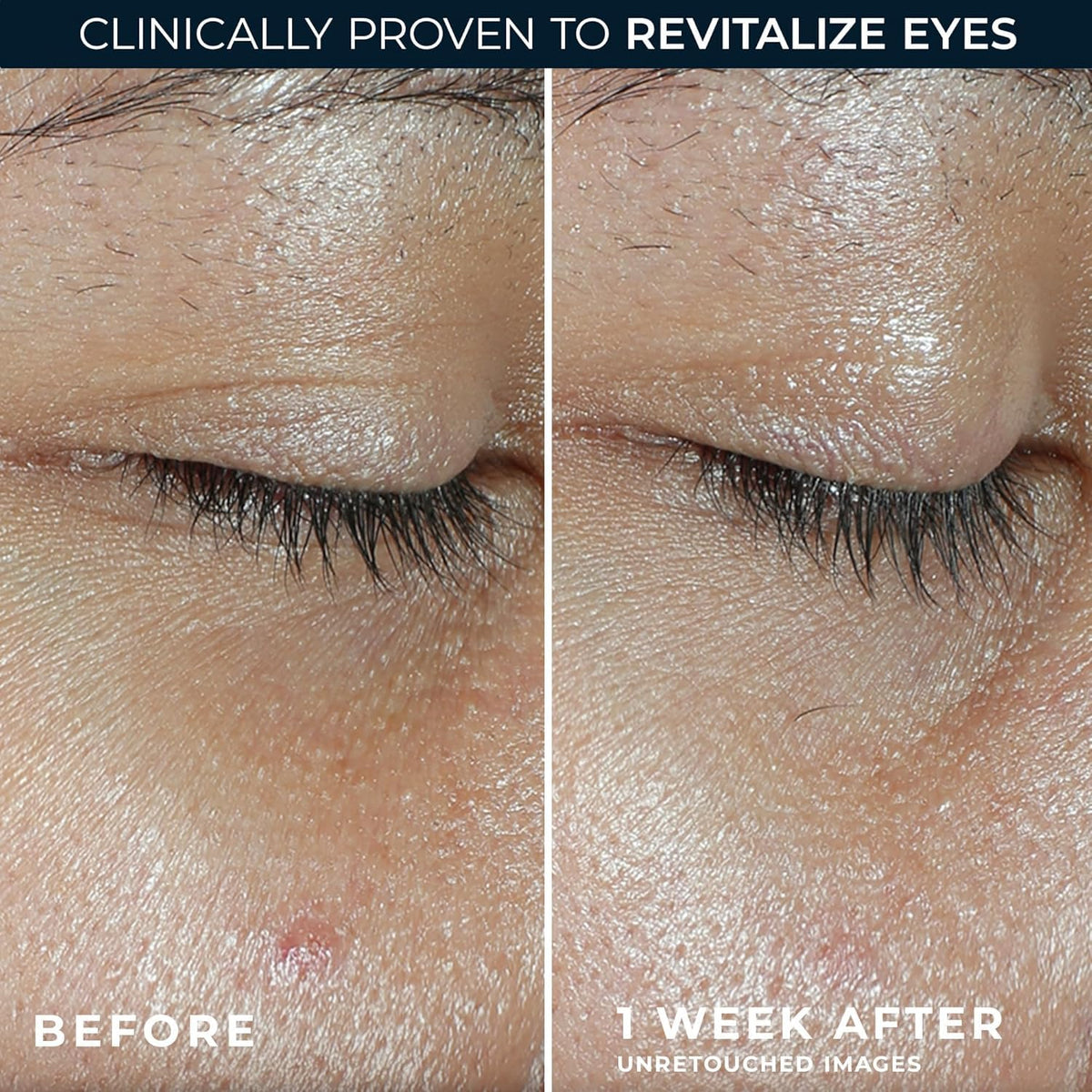RoC Multi Correxion Revive + Glow Eye Balm (0.14 oz) with Vitamin C | Includes Retinol Eye Cream Sample Packette