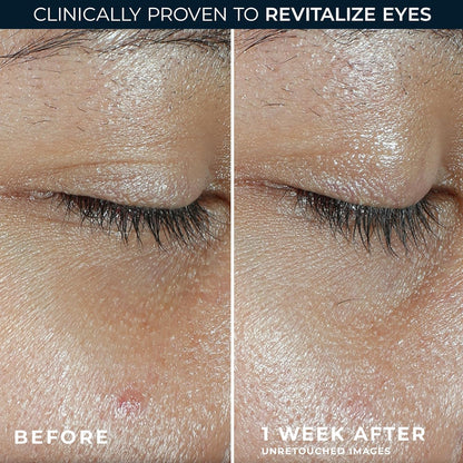 RoC Multi Correxion Revive + Glow Eye Balm (0.14 oz) with Vitamin C | Includes Retinol Eye Cream Sample Packette