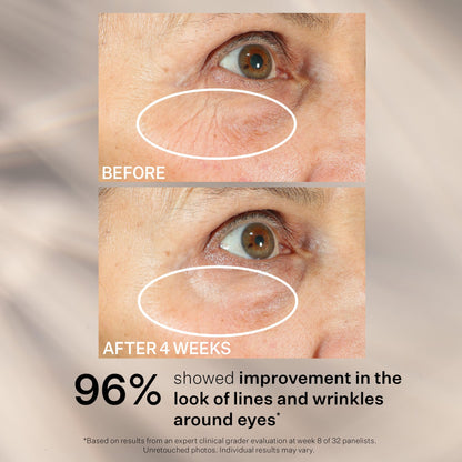 StriVectin Peptight™ 360° Tightening Eye Serum (1 fl. oz) - Advanced Peptides for Wrinkles, Eye Bags & Sagging Lids
