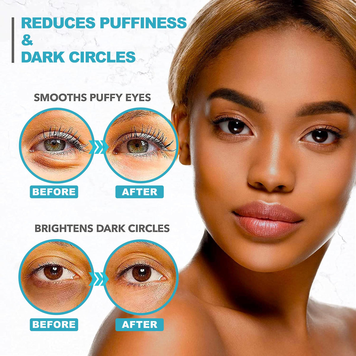 Retinol Collagen Under Eye Patches – Eye Masks for Puffy Eyes, Dark Circles & Wrinkles (60 Gel Pads)