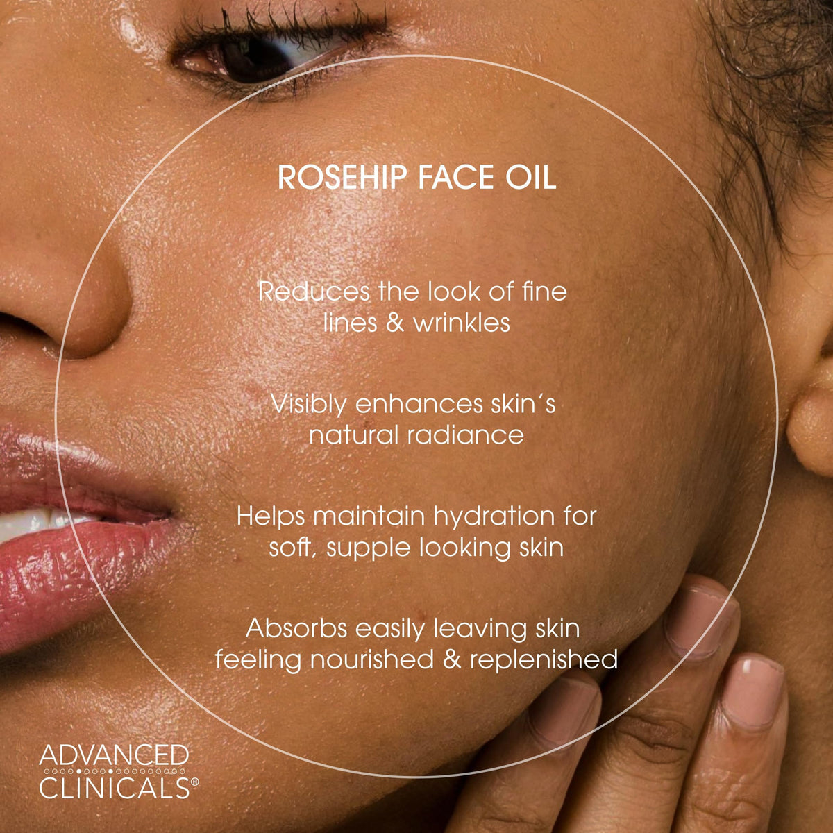 Advanced Clinicals Rosehip Oil Serum – Vitamin E & Botanical Infusion (52ml)