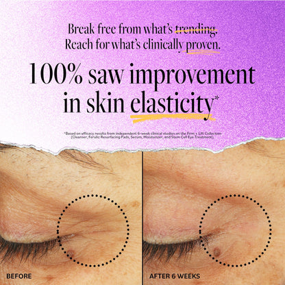Derma E Stem Cell Lifting Eye Treatment (0.5 oz) – Multi-Action Firming & Tightening for Under Eye & Upper Eyelids