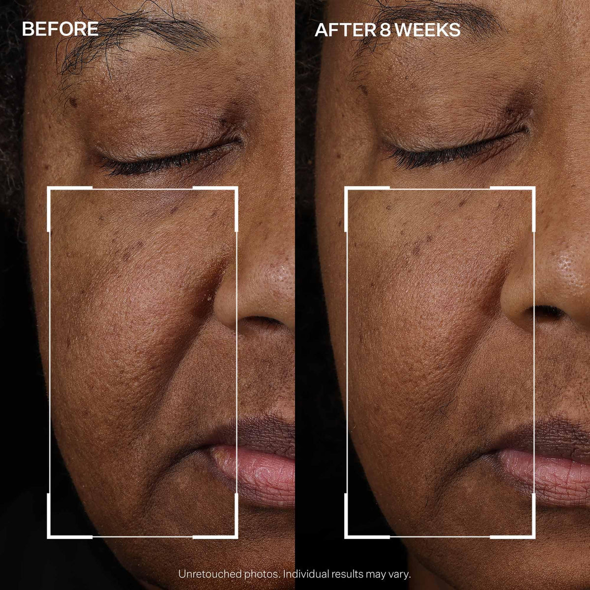 StriVectin Peptight™ Face Lift Serum (30 mL) - Tightening & Brightening Peptides for Wrinkles and Facial Contours