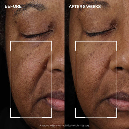 StriVectin Peptight™ Face Lift Serum (30 mL) - Tightening & Brightening Peptides for Wrinkles and Facial Contours